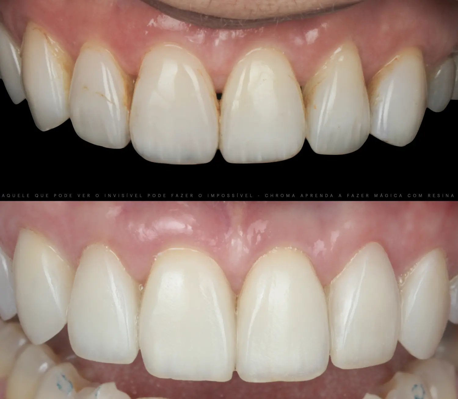 Caso 10 · antes e depois