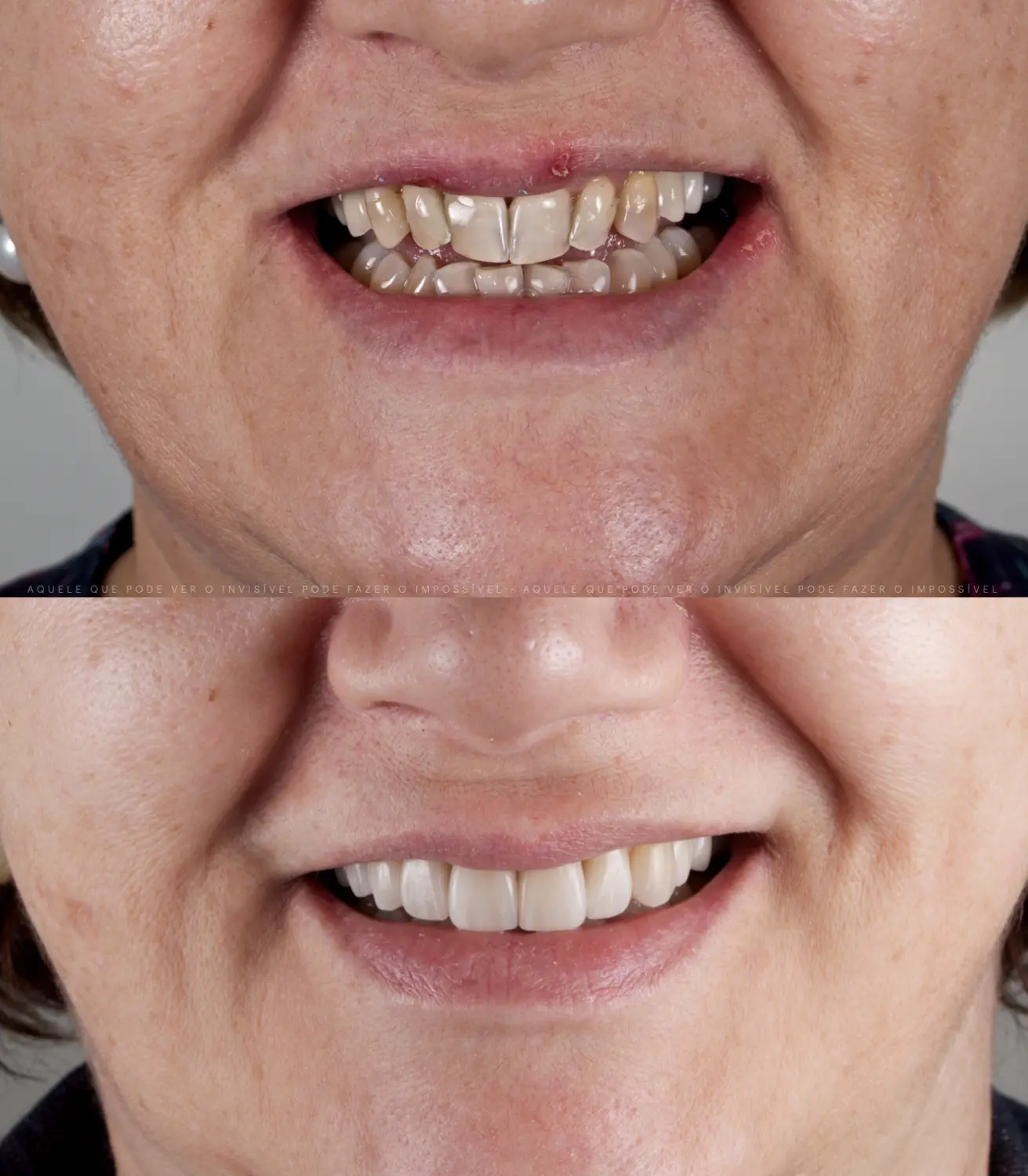 Caso 2 · antes e depois