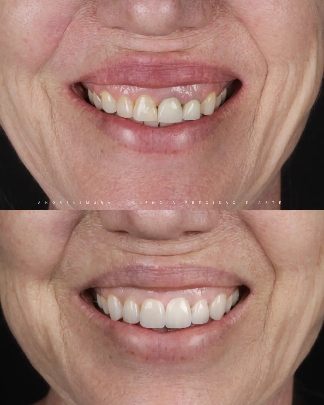Caso 3 · antes e depois
