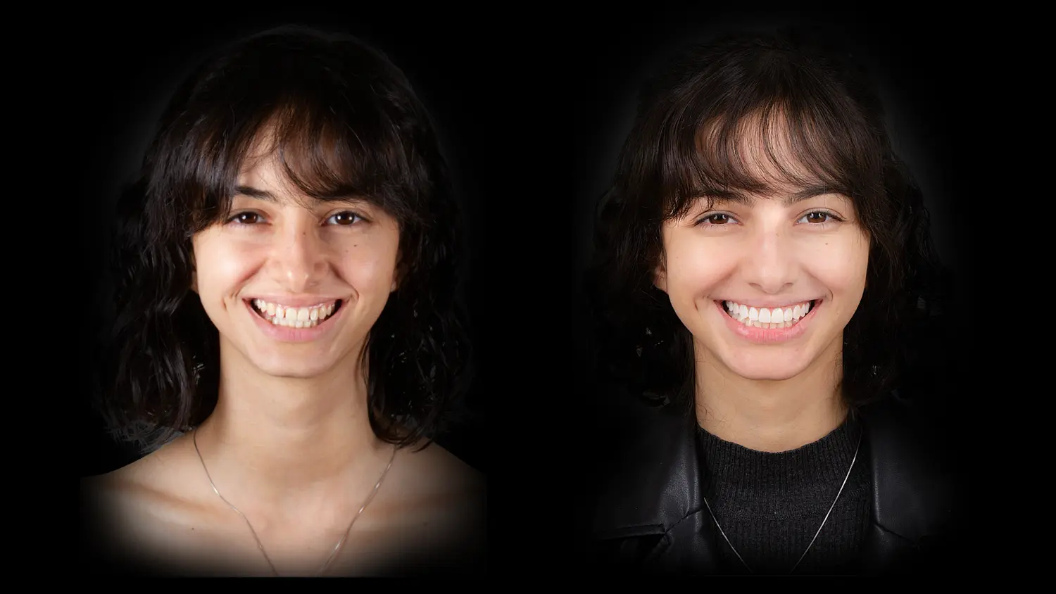 Caso 6 · antes e depois