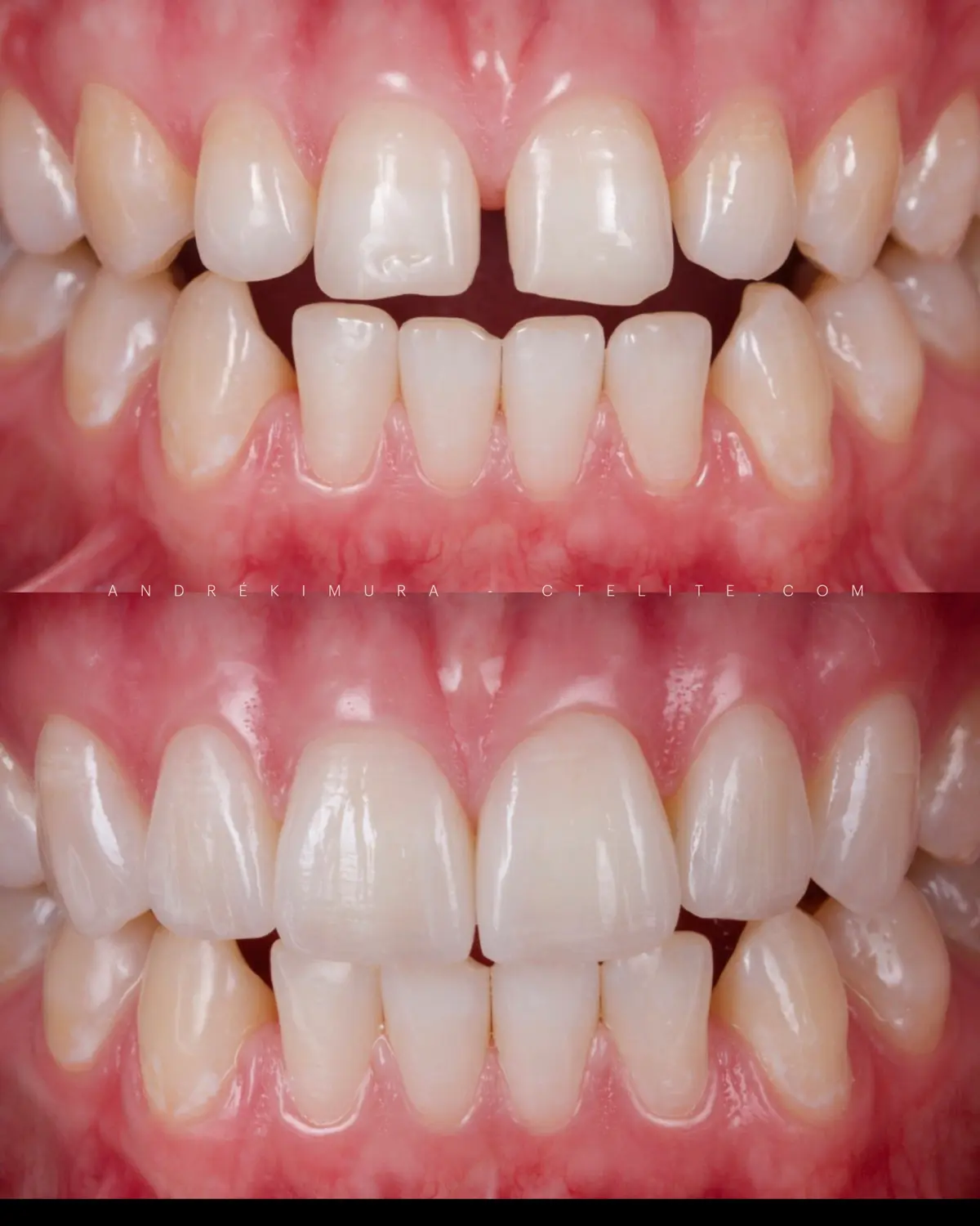 Caso 7 · antes e depois