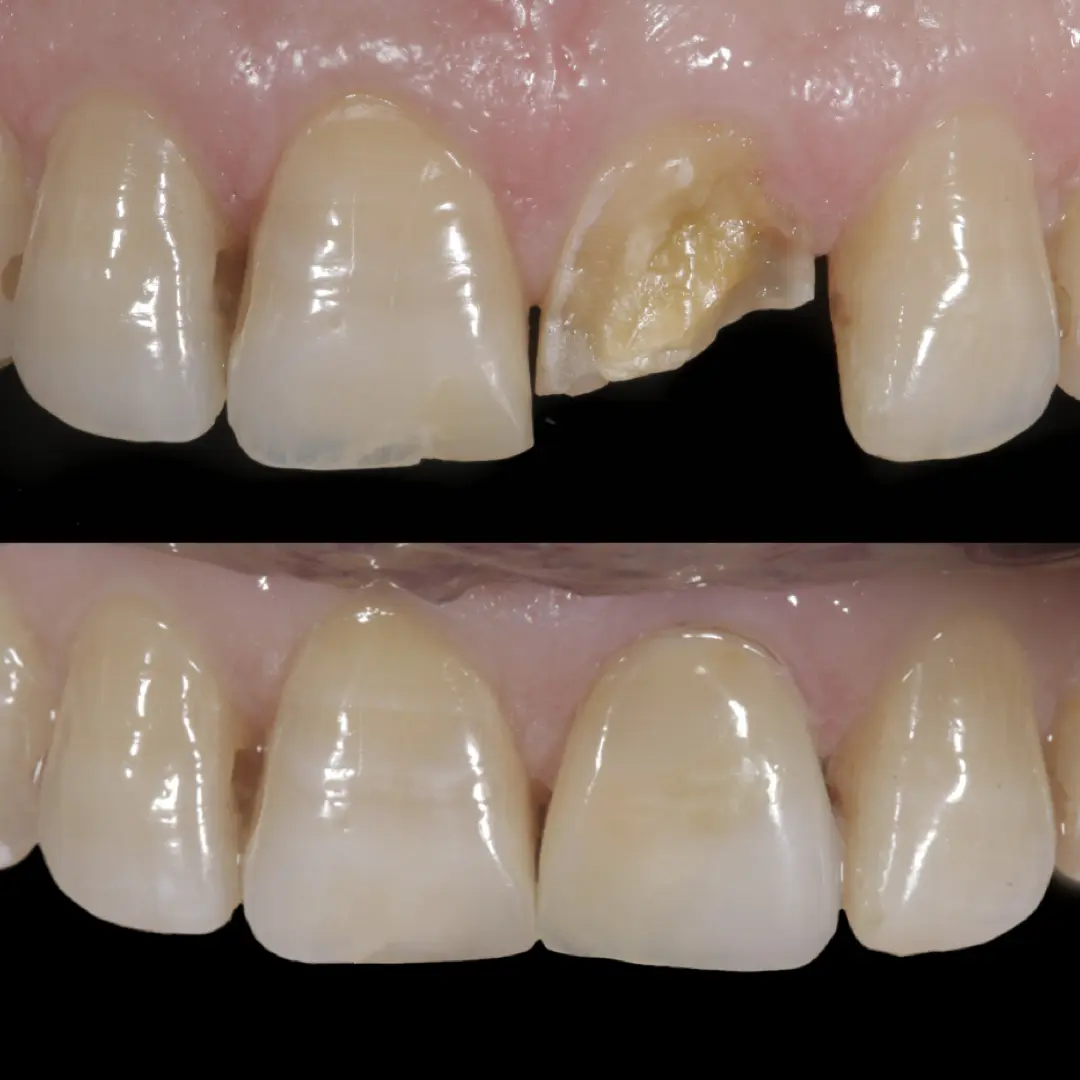 Caso 8 · antes e depois